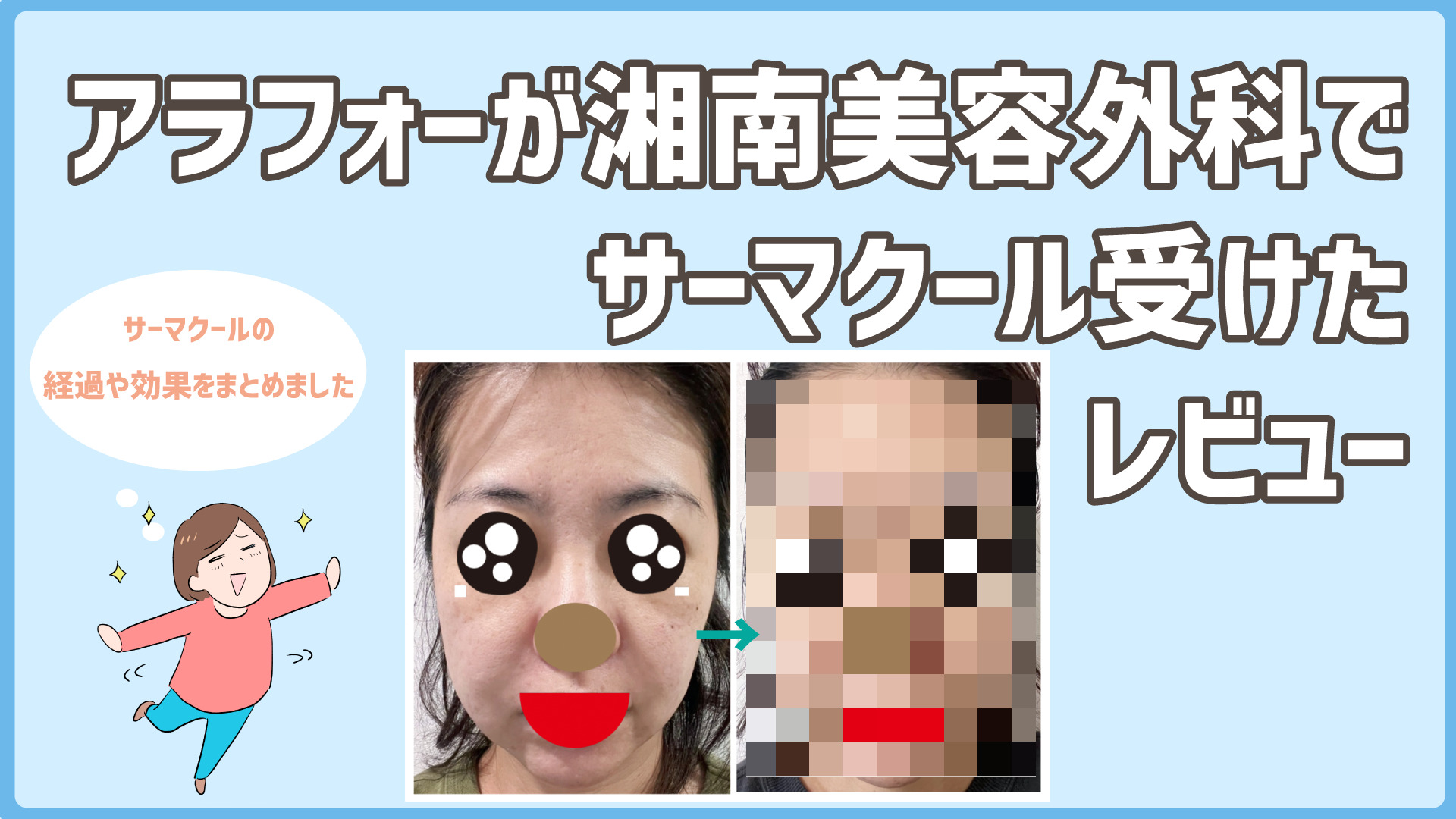 湘南美容外科 サーマクール 体験談